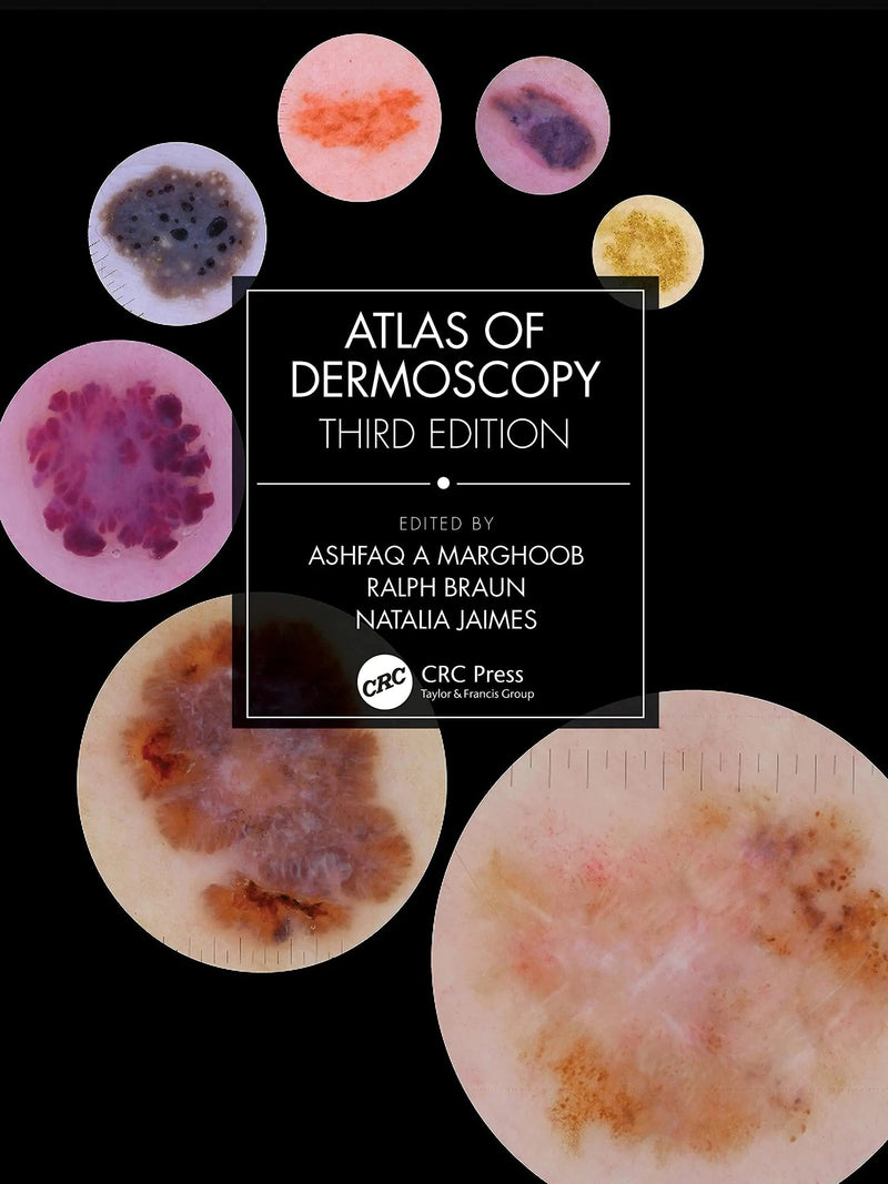 Atlas of Dermoscopy by Ashfaq A. Marghoob 3rd Edition ISBN 9781138595989