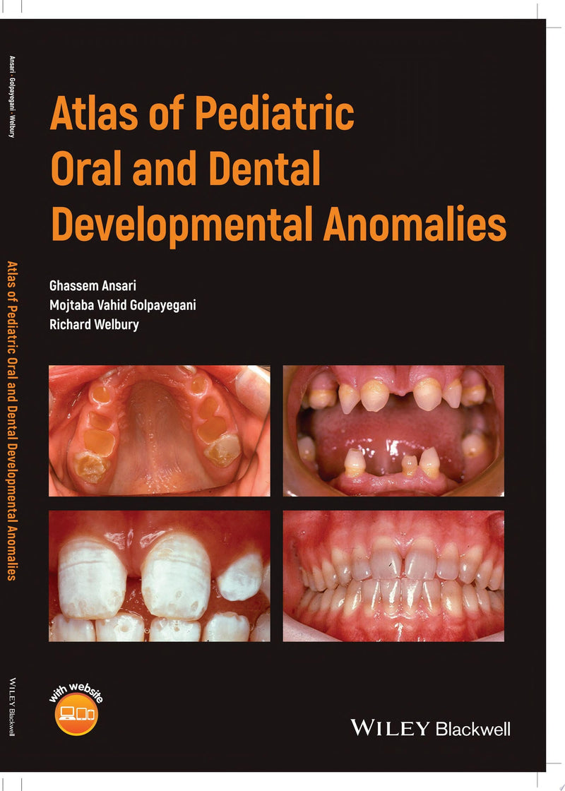 Atlas of Pediatric Oral and Dental Developmental Anomalies 1st Edition