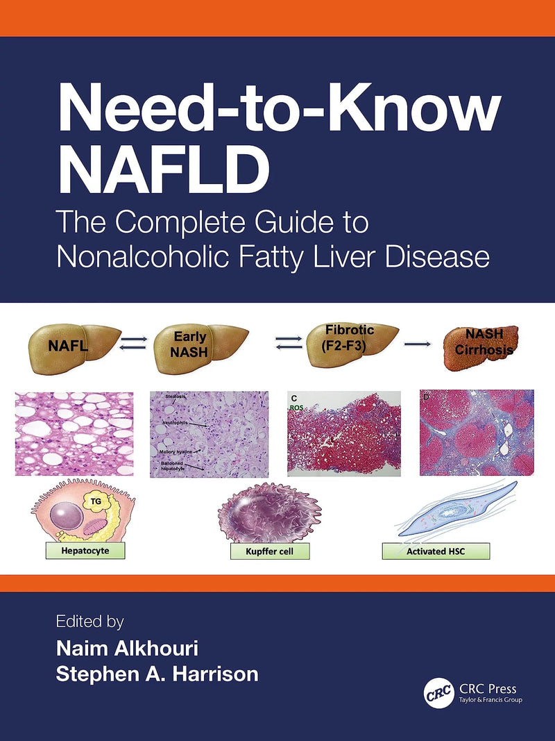 Need-To-Know NAFLD The Complete Guide to Nonalcoholic Fatty Liver Disease by Naim Alkhouri 1st Edition ISBN 9781032479484