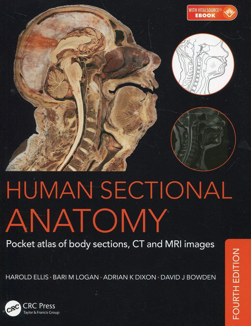 Human Sectional Anatomy Pocket Atlas of Body Sections, CT and MRI Images, Fourth Edition by Adrian Kendal Dixon ISBN 9781498708548