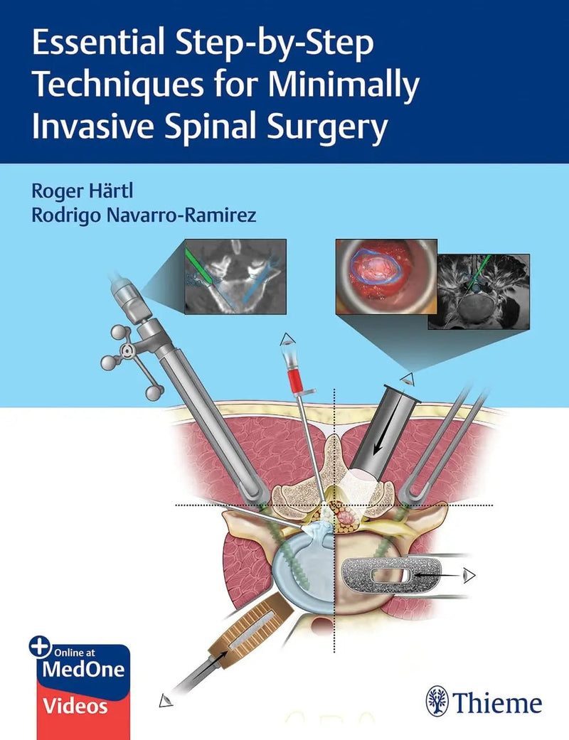 Essential Step-By-Step Techniques for Minimally Invasive Spinal Surgery by Roger Hartl 1st Edition ISBN 9781684200092