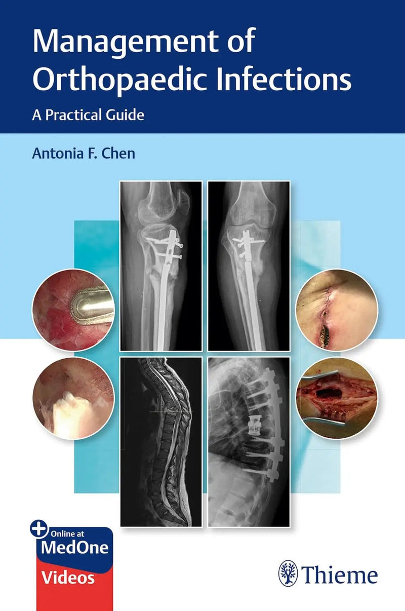Management of Orthopaedic Infections A Practical Guide by Antonia Chen 1st Edition ISBN 9781684201334