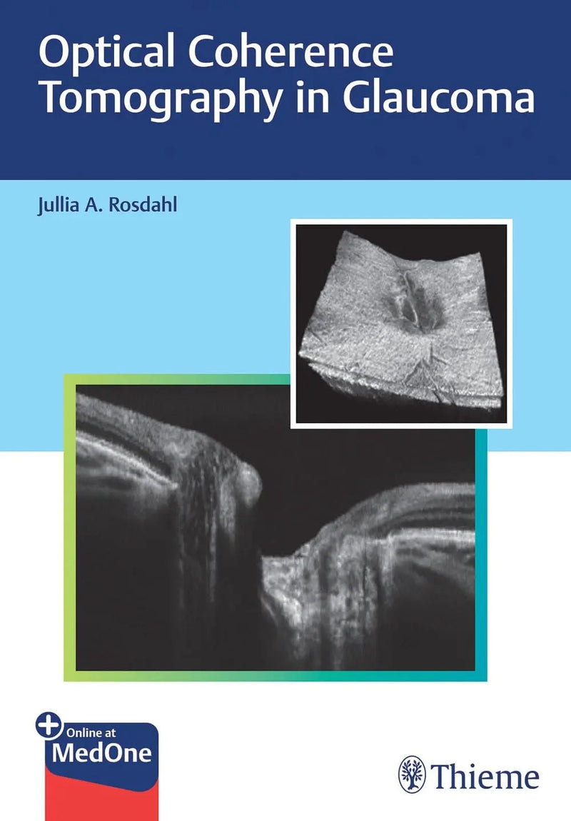Optical Coherence Tomography in Glaucoma by Jullia Rosdahl 1st Edition ISBN 9781684202478