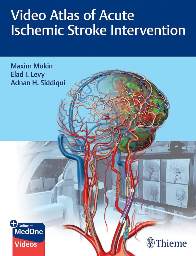Video Atlas of Acute Ischemic Stroke Intervention by Maxim Mokin 1st Edition ISBN 9781684202492
