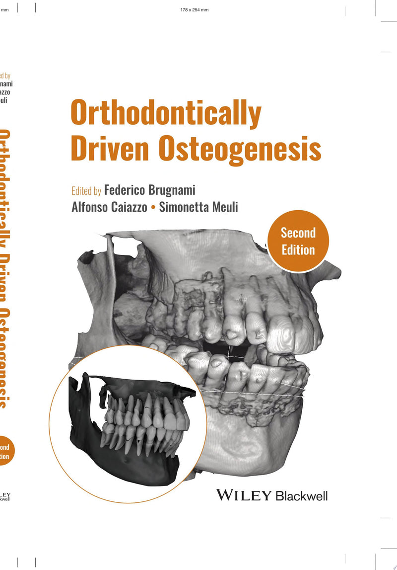 Orthodontically Driven Osteogenesis 2nd Edition