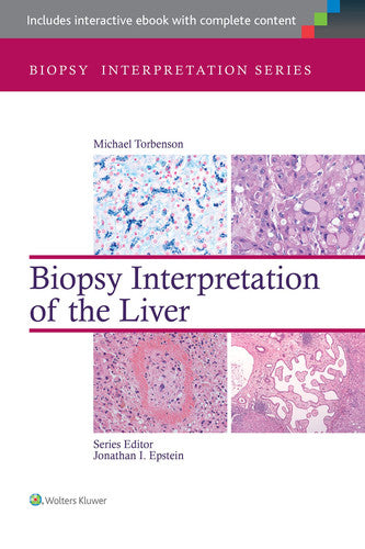 Biopsy Interpretation of the Liver by Michael S. Torbenson