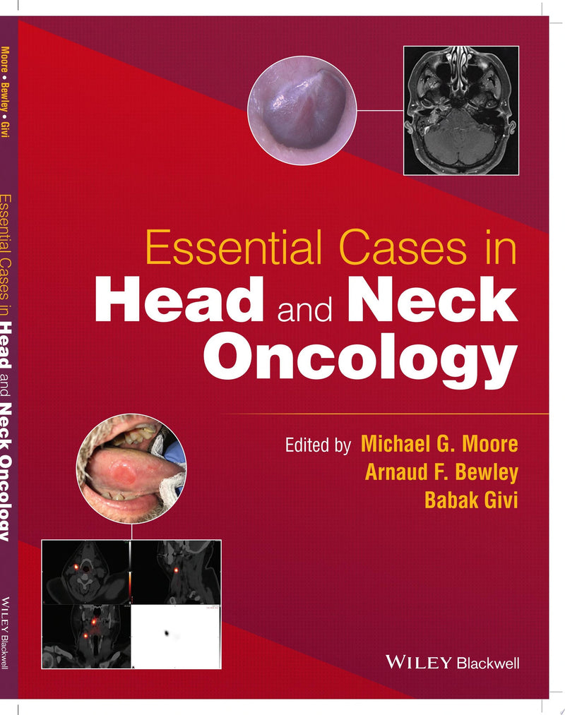 Essential Cases in Head and Neck Oncology 1st Edition