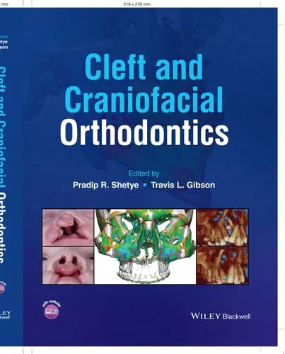 Cleft and Craniofacial Orthodontics by Pradip R. Shetye ISBN: 978-1119778349