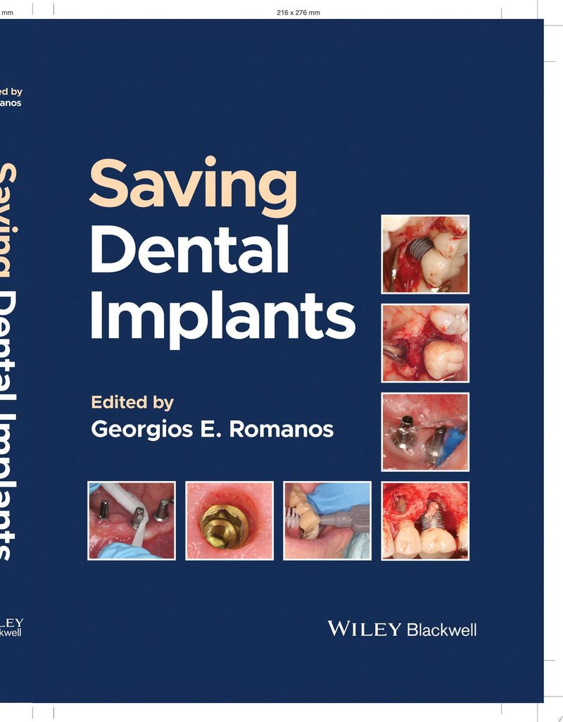 Saving Dental Implants 1st Edition