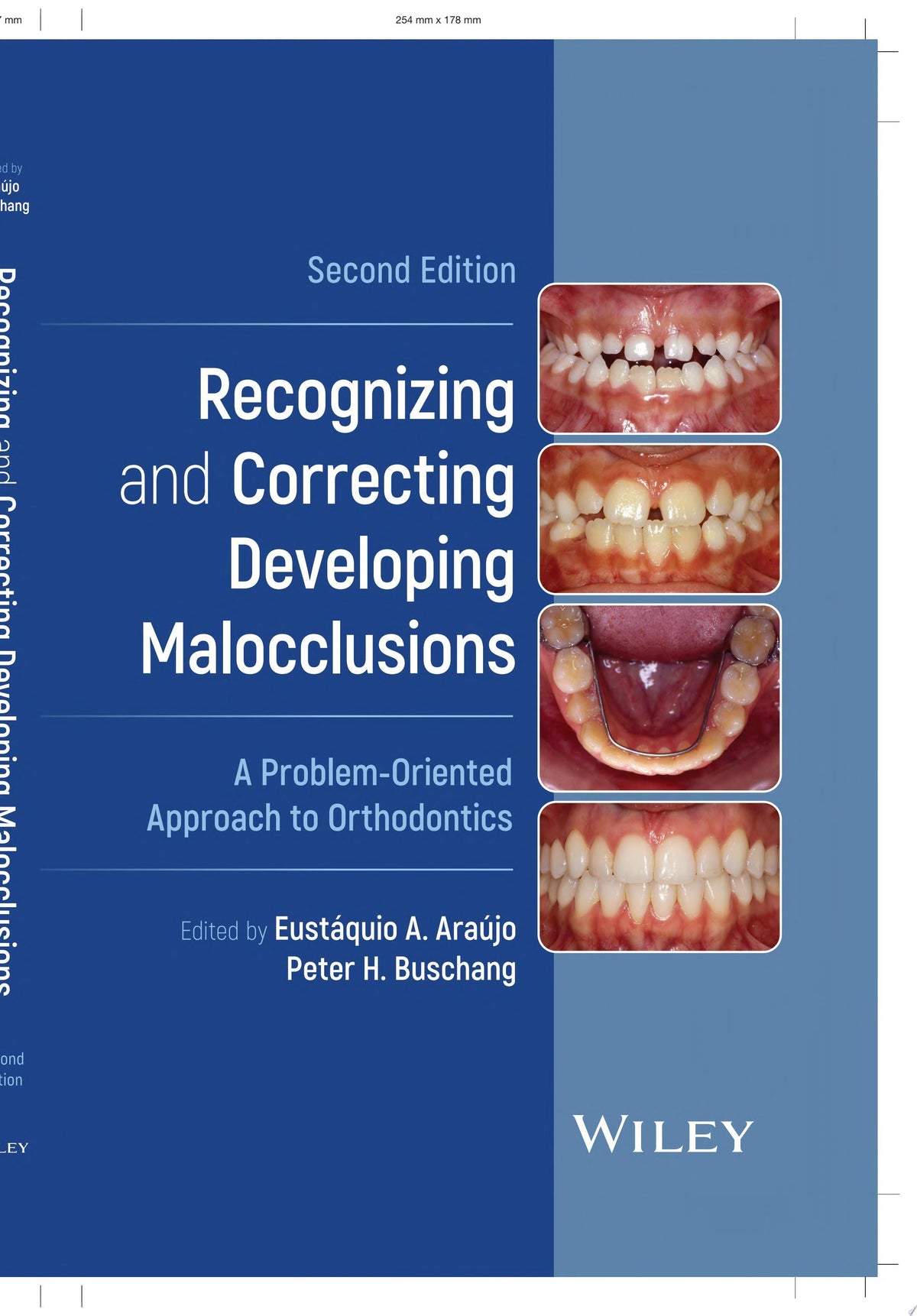 Recognizing and Correcting Developing Malocclusions A Problem-Oriented Approach to Orthodontics 2nd Edition - front cover