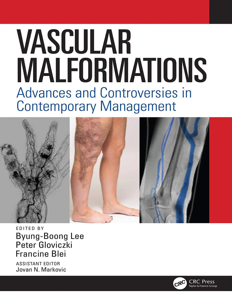 Vascular Malformations Advances and Controversies in Contemporary Management by Byung Boong Lee 1st Edition ISBN 9780367250126