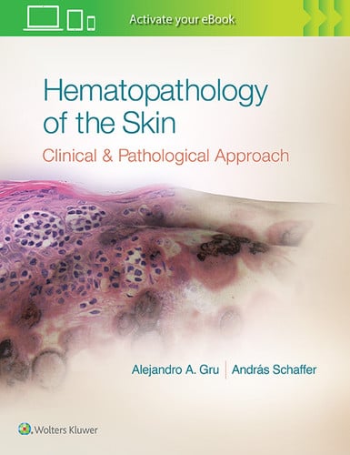 Hematopathology of the Skin Clinical and Pathological Approach by Alejandro Ariel Gru