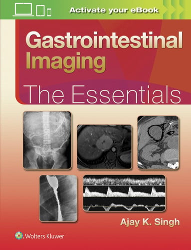 Gastrointestinal Imaging The Essentials by Ajay Singh
