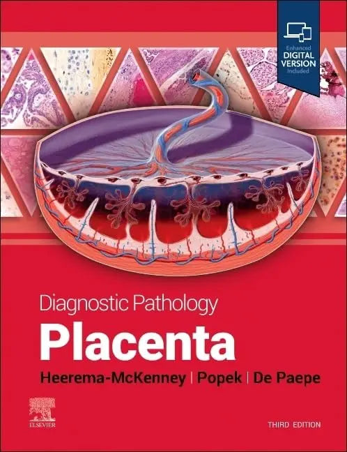 Diagnostic Pathology: Placenta by Amy Heerema-McKenney 3rd Edition ISBN 9780443116544