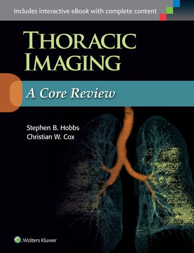 Thoracic Imaging A Core Review by Stephen Hobbs