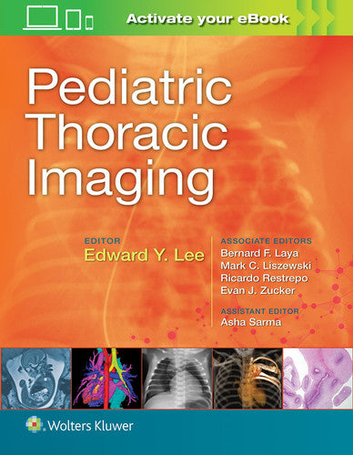 Pediatric Thoracic Imaging by Edward Y. Lee