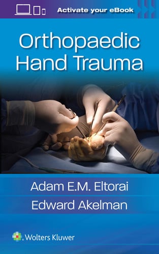 Orthopaedic Hand Trauma by Adam E. M. Eltorai