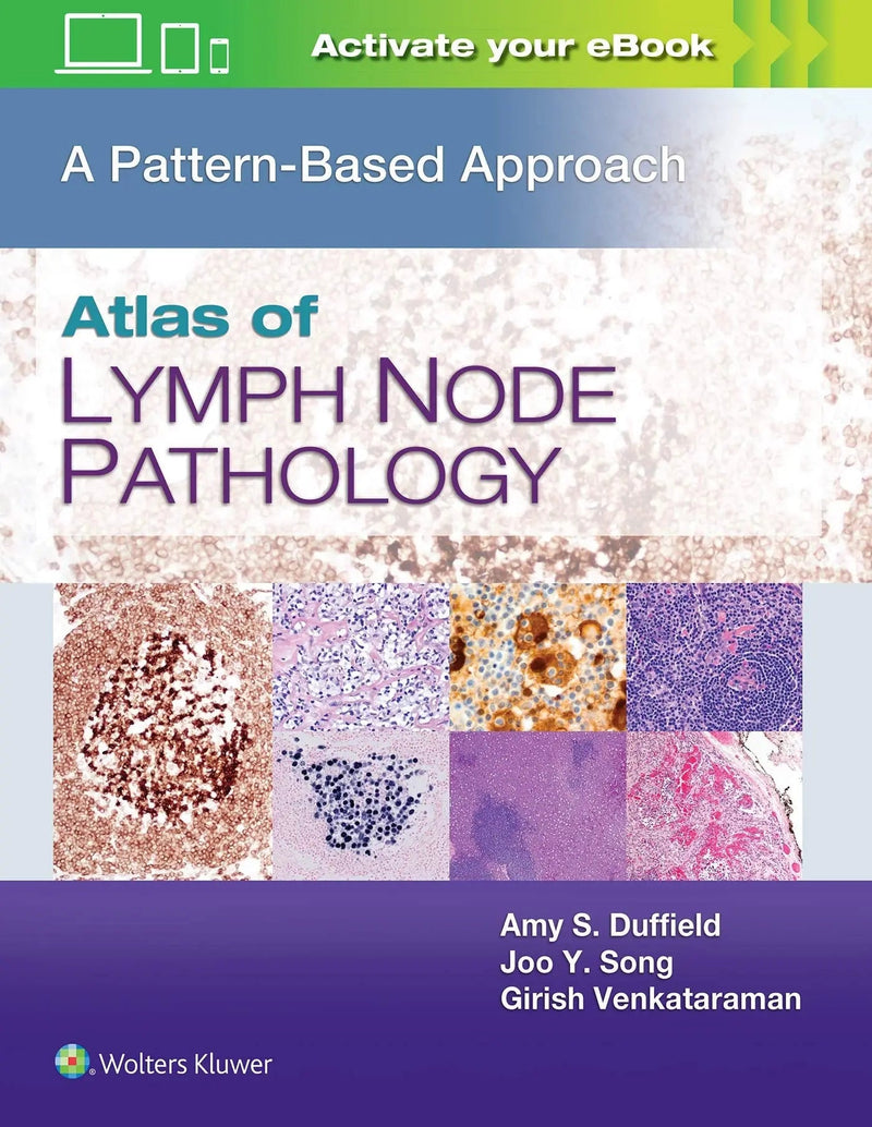 Atlas of Lymph Node Pathology A Pattern Based Approach by Amy S. Duffield 1st Edition