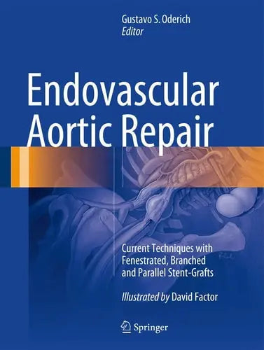 Endovascular Aortic Repair Current Techniques with Fenestrated, Branched and Parallel Stent-Grafts by Gustavo S. Oderich