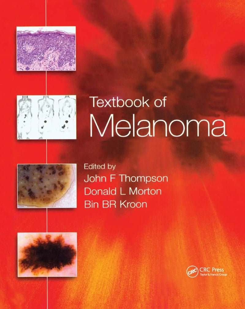 Textbook of Melanoma Pathology, Diagnosis and Management by John F. Thompson 1st Edition ISBN 9780367394974