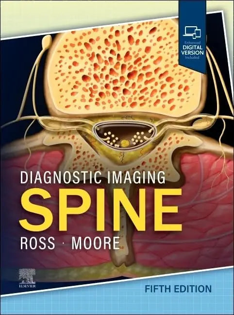 Diagnostic Imaging: Spine by Jeffrey S. Ross 5th Edition ISBN 9780443378812