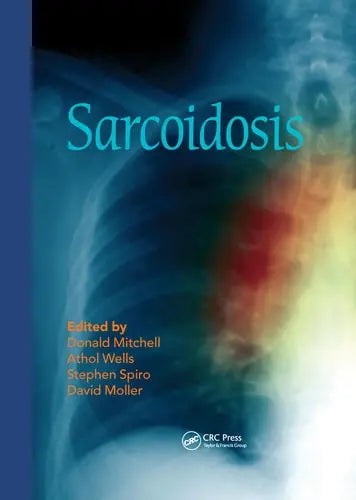 Sarcoidosis by Donald Mitchell 978-0367576769