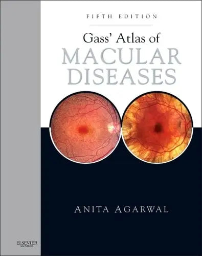 Gass' Atlas of Macular Diseases 2-Volume Set - Expert Consult: Online and Print by Anita Agarwal ISBN: 978-1437715804