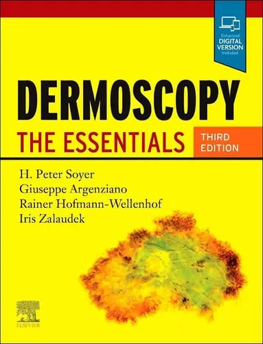 Dermoscopy The Essentials by H. Peter Soyer 978-0702068829