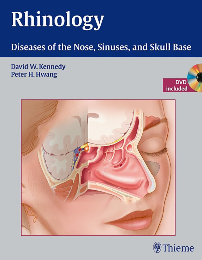 Rhinology Diseases of the Nose, Sinuses, and Skull Base 1st Edition
