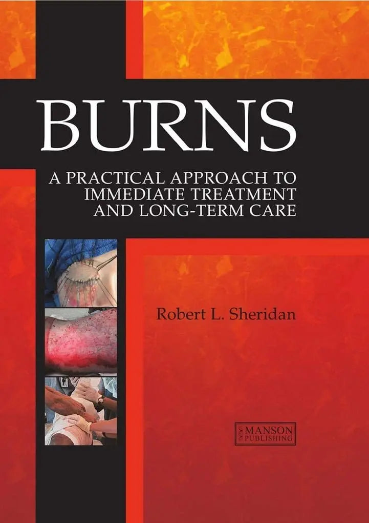 Burns A Practical Approach to Immediate Treatment and Long-Term Care by Robert Sheridan 1st Edition ISBN 9781626237032