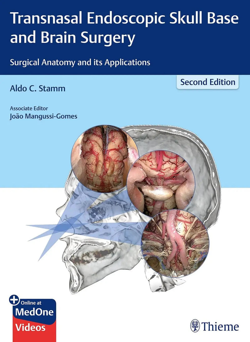 Transnasal Endoscopic Skull Base and Brain Surgery Surgical Anatomy and Its Applications by Aldo C. Stamm 2nd Edition ISBN 9781626237100