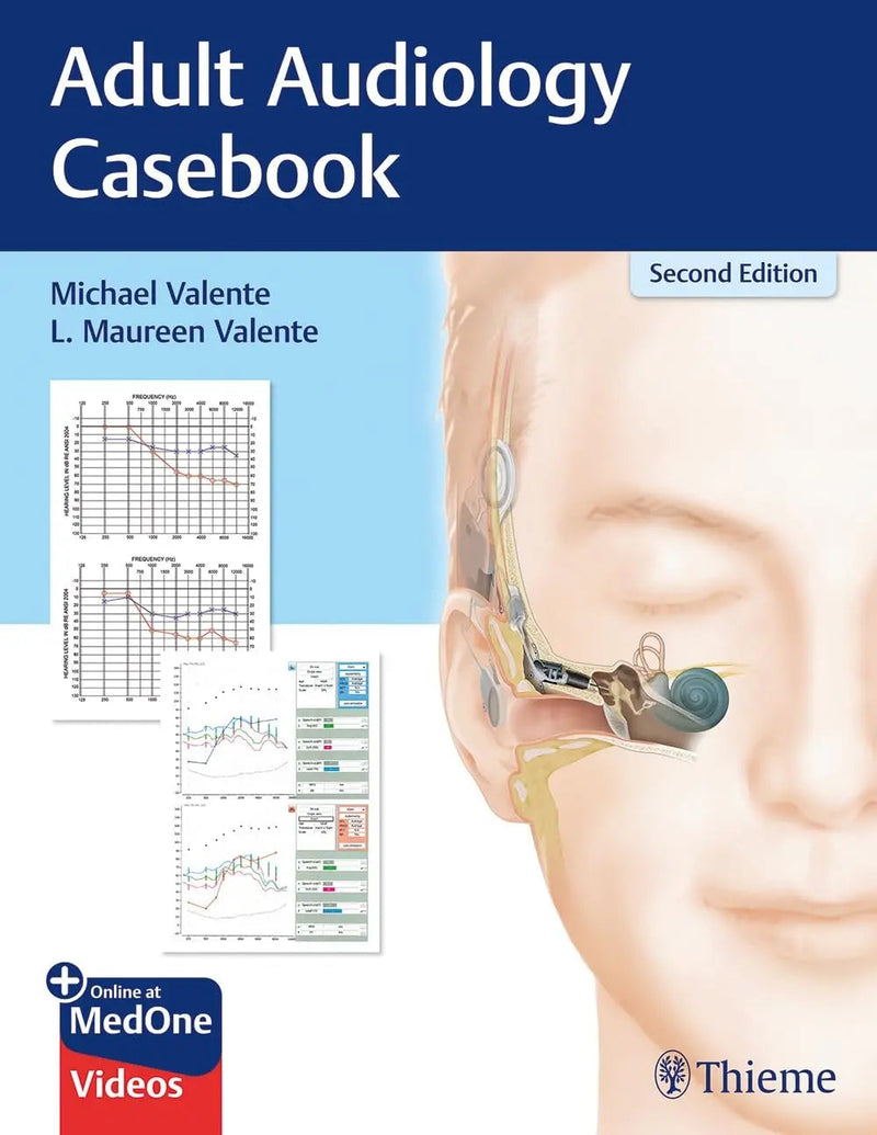 Adult Audiology Casebook by Michael Valente 2nd Edition ISBN 9781626237292