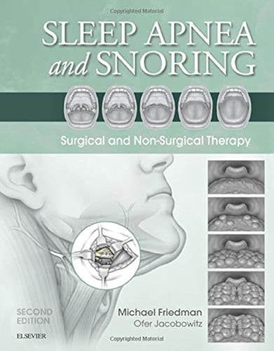 Sleep Apnea and Snoring Surgical and Non-Surgical Therapy by Michael Friedman