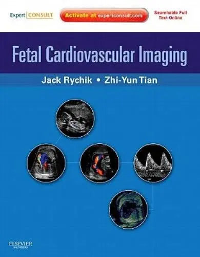 Fetal Cardiovascular Imaging A Disease-based Approach by Jack Rychik ISBN: 978-1416031727