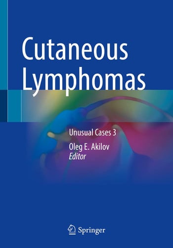 Cutaneous Lymphomas Unusual Cases 3 by Oleg E. Akilov