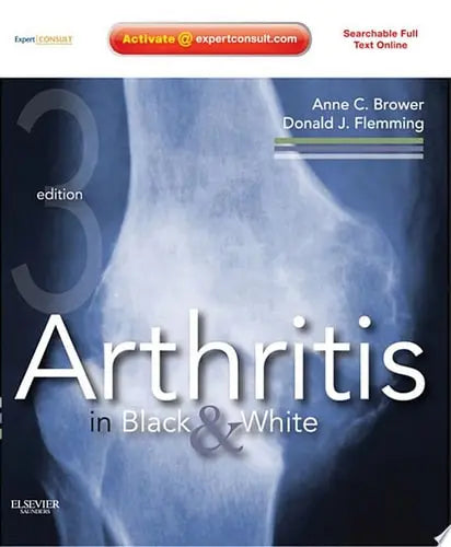 Arthritis in Black and White Expert Consult - Online and Print by Anne C. Brower ISBN: 978-1416055952