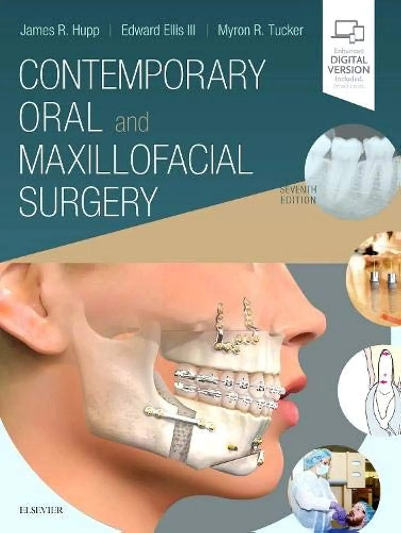 Contemporary Oral and Maxillofacial Surgery by James R. Hupp 7th Edition ISBN 9780323552219