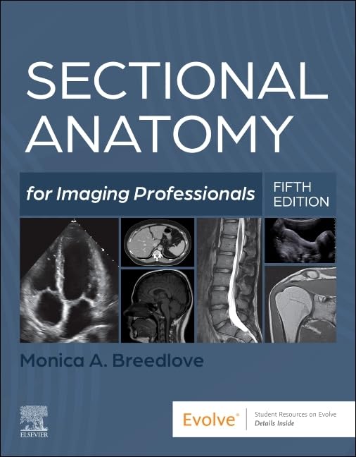 Sectional Anatomy for Imaging Professionals by Monica Breedlove 5th Edition ISBN 9780323827881