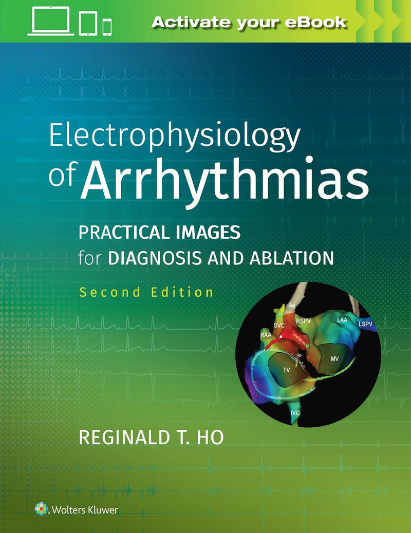 Electrophysiology of Arrhythmias Practical Images for Diagnosis and Ablation 2nd Edition