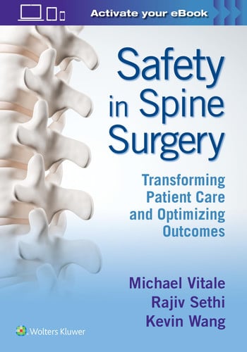 Safety in Spine Surgery Transforming Patient Care and Optimizing Outcomes by Michael Vitale