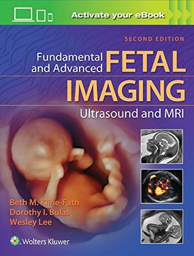 Fundamental and Advanced Fetal Imaging Ultrasound and MRI 2nd Edition