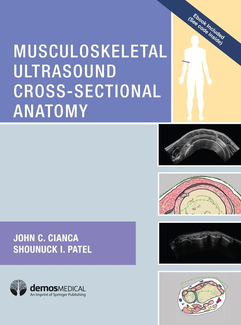 Musculoskeletal Ultrasound Cross Sectional Anatomy by John C. Cianca 1st Edition ISBN 9781620700624