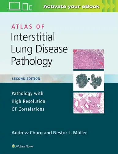 Atlas of Interstitial Lung Disease Pathology by Andrew Churg ISBN: 978-1975124670