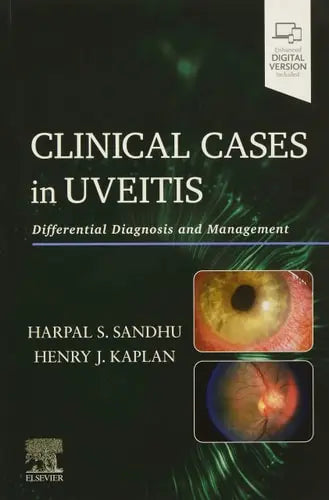 Clinical Cases in Uveitis Differential Diagnosis and Management by Harpal Sandhu 1st Edition ISBN 9780323695411