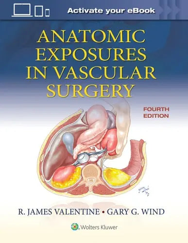 Anatomic Exposures in Vascular Surgery by R. James Valentine ISBN: 978-1975152765