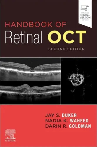 Handbook of Retinal OCT: Optical Coherence Tomography by Jay S. Duker 2nd Edition ISBN 9780323757720
