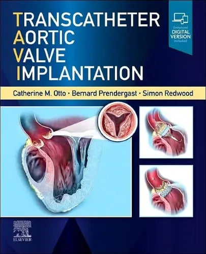 Transcatheter Aortic Valve Implantation by Catherine M. Otto 1st Edition ISBN 9780323757928