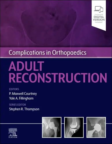 Complications in Orthopaedics: Adult Reconstruction by Paul Maxwell Courtney 1st Edition ISBN 9780323824378