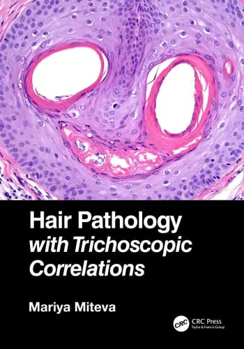 Hair Pathology with Trichoscopic Correlations by Mariya I. Miteva ISBN: 978-1138313538