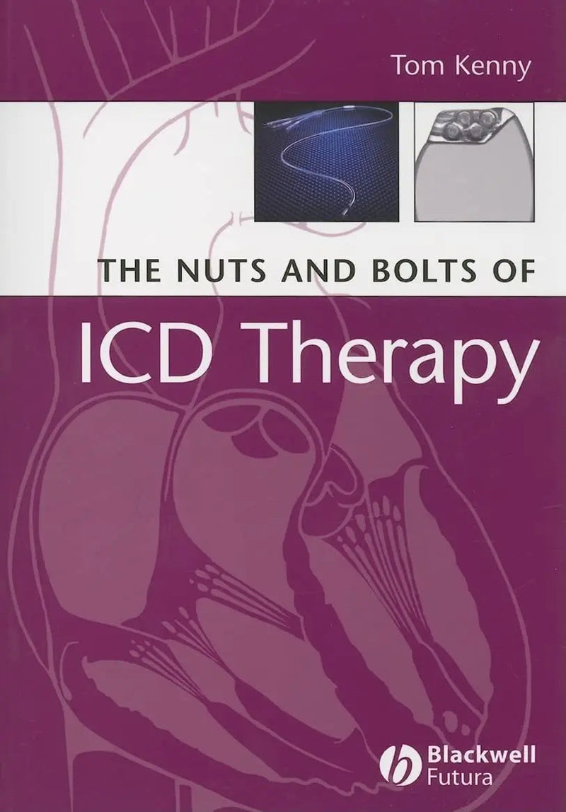 The Nuts and Bolts of ICD Therapy by Tom Kenny 1st Edition ISBN 9781405135115
